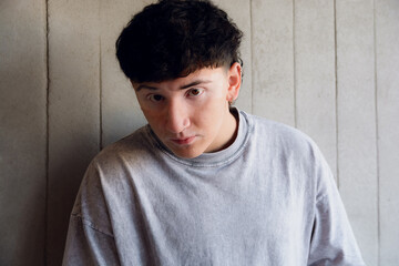 Portrait of a young Argentinian with vitiligo, short hair and brown eyes