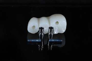 In dental and cosmetic dentistry, bone-anchored dental implant treatment with porcelain bridge prostheses and implant screws.  © UniqDream
