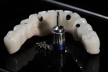 The All-on-4, All-on-X, and All-on-4 treatment concepts in dental implant therapy provide full arch...