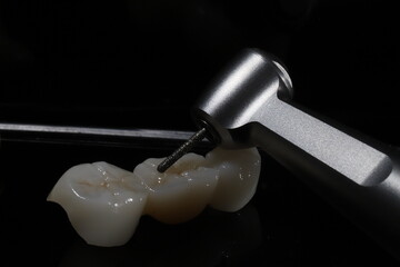 E-max or zirconia glass ceramic porcelain bridge crown treatment and implant-supported crown treatment used in dental dentistry for cases of tooth loss. Smile design. © UniqDream