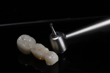 E-max or zirconia glass ceramic porcelain bridge crown treatment and implant-supported crown treatment used in dental dentistry for cases of tooth loss. Smile design. © UniqDream