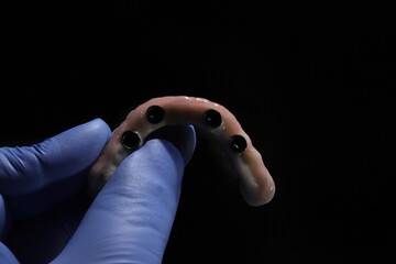 The All-on-4, All-on-X, and All-on-4 treatment concepts in dental implant therapy provide full arch dental prosthesis for completely edentulous jaws. Dental implants are a dentistry treatment placed  © UniqDream