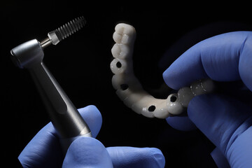 The All-on-4, All-on-X, and All-on-4 treatment concepts in dental implant therapy provide full arch...