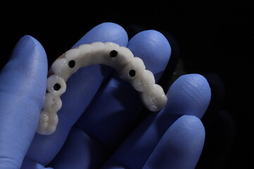 The All-on-4, All-on-X, and All-on-4 treatment concepts in dental implant therapy provide full arch dental prosthesis for completely edentulous jaws. Dental implants are a dentistry treatment placed  © UniqDream