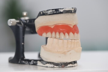 Full arch dental prosthesis treatment applied to edentulous jaws. The complete denture, known as a...