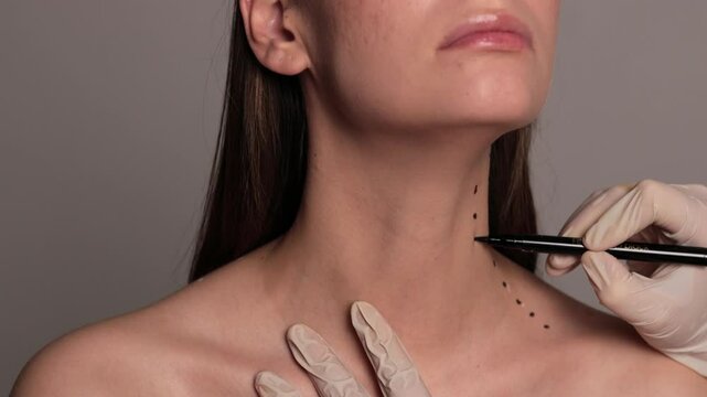 Mark up before Nefertiti lifting 4k video. Cosmetologist is drawing dotes before botulinum toxin injection in platysma of a woman. Improving neck by a professional. Female aesthetic cosmetology.