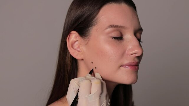 Bruxism markup for teeth grinding by a cosmetologist 4k video. Bruxism facial marking for a treatment with botulinum toxin in an aesthetic medicine clinic.