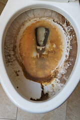 Dirty Gross Toilet Bowl