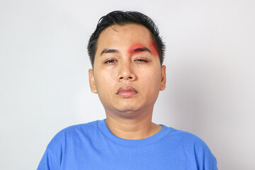 Obraz premium Head pain medicines pills concept. Cephalalgia and migraine. Man with sinus headache, tension or cluster headache on gray studio. Migraine symptoms. Chronic headaches. Headache triggers.