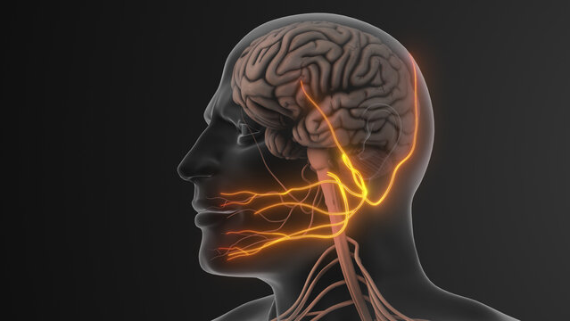 Facial Pain Triggered by Trigeminal Nerve Compression