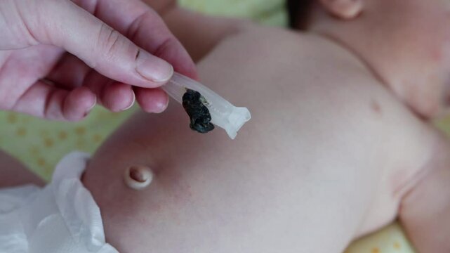 Dried umbilical cord in hand against the background of a newborn baby, close-up