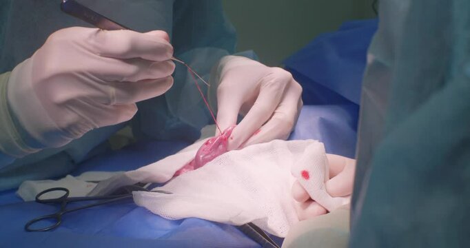 Veterinarians carefully remove a needle and thread from a cat's intestines during surgery. The cat has swallowed the needle and thread, and a team of veterinary surgeons are performing the surgery.