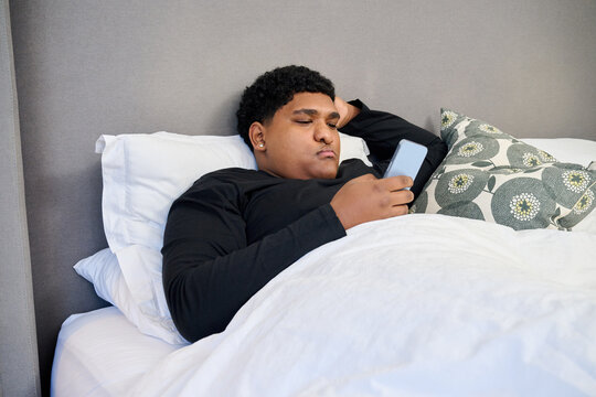 Man with cleft palate in bed