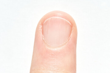 Close up view of a human fingernail on a caucasian adult finger.
