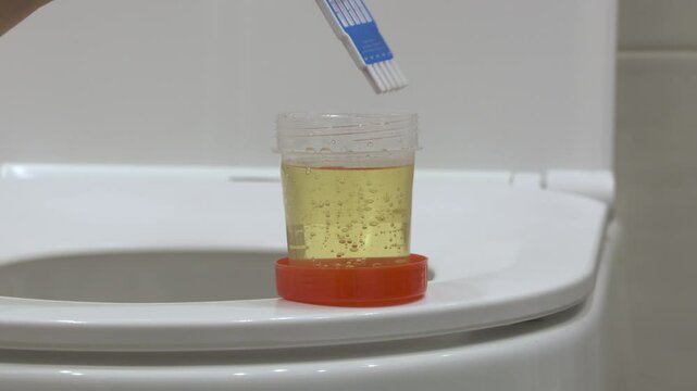 Russian multi panel drug screening test. Urine drug screen rapid test ten drugs. Urine drug screening at home. Urine rapid drug test detects whether someone has recently used drugs.