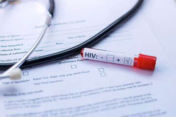 Obraz premium High Angle of Stethoscope and HIV Test Tube With Blood Plasma on Medical Report 