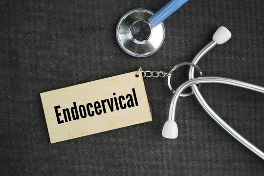 stethoscope and wooden tag with the word endocervical. (EN-doh-SER-vix) The inner part of the cervix that forms a canal that connects the vagina to the uterus