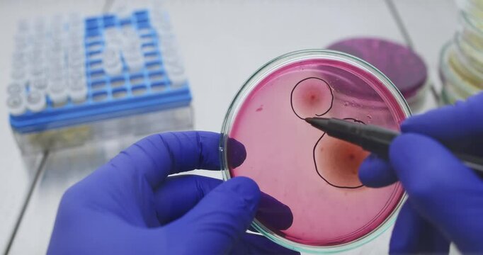 A scientist marks the growth zone of bacterial colonies on a petri dish in a laboratory, close-up.