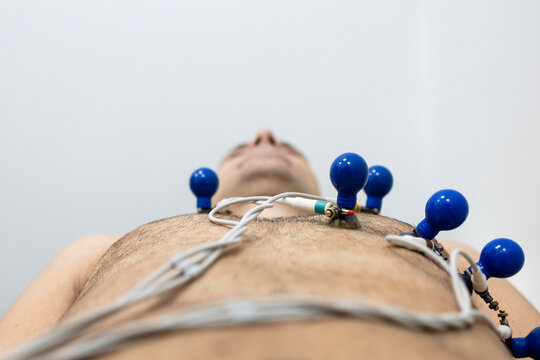 Cardiology medical examination. Electrocardiography procedure with electrodes attached to the patient chest.