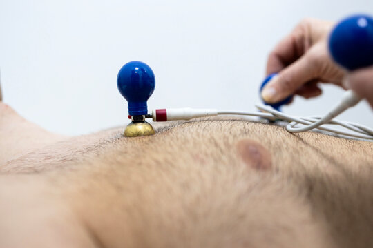 Close up view of electrocardiography electrodes attached to the patient chest measuring heart beat and rhythm.