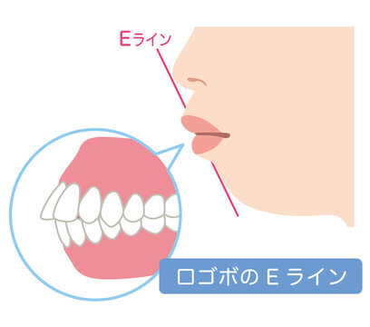 口ゴボのEライン　横顔