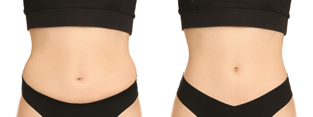 Woman showing her belly with excess fat on one side and slim on other, closeup. Collage with photos...