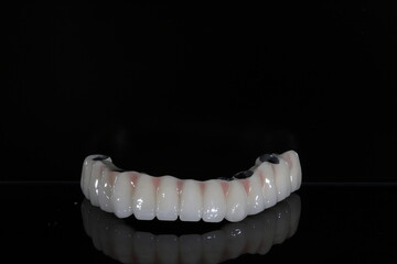 Full-arch porcelain implant-supported dental prosthesis for edentulous jaws with All-on-X and All-on-4 treatment procedure using dental implant surgery.
