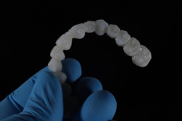 3D-printed jaw model and full-mouth zirconium porcelain crowns. Computer-assisted smile design treatment. dental before after.  © UniqDream