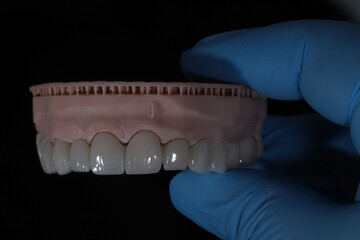 3D-printed jaw model and full-mouth zirconium porcelain crowns. Computer-assisted smile design treatment. dental before after.  © UniqDream