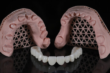 Dental zirconium porcelain crowns placed on a digital model. Aesthetic visual with dental smile design. © UniqDream