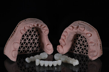 Dental zirconium porcelain crowns placed on a digital model. Aesthetic visual with dental smile design. © UniqDream