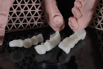 Dental zirconium porcelain crowns placed on a digital model. Aesthetic visual with dental smile design. © UniqDream
