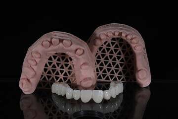 Dental zirconium porcelain crowns placed on a digital model. Aesthetic visual with dental smile design. © UniqDream