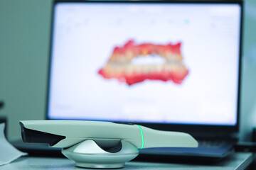 Intraoral digital scanner used in dental digital dentistry. A scanning device that transfers the measurements of the oral cavity to a computer environment.   © UniqDream