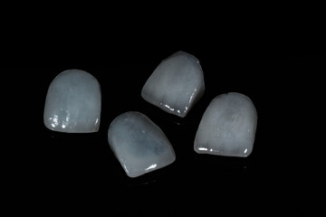 Dental porcelain crowns. Dental laminate veneers in smile design treatment in dentistry. Smile makeover.  © UniqDream