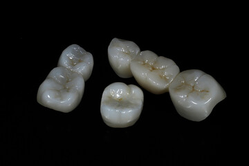 E-max or zirconia glass ceramic porcelain bridge crown treatment and implant-supported crown treatment used in dental dentistry for cases of tooth loss. Smile design. © UniqDream