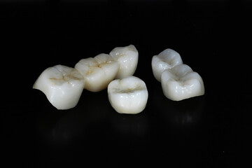 E-max or zirconia glass ceramic porcelain bridge crown treatment and implant-supported crown treatment used in dental dentistry for cases of tooth loss. Smile design. © UniqDream