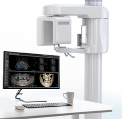 In dental implant surgery, the All-on-Four, All-on-4, and All-on-X treatments involve placing full-arch dental prostheses on cylindrical titanium implants applied to the upper jaw. Dental before after © UniqDream