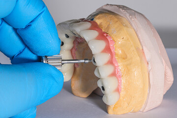 Full-arch dental prosthesis torque wrench and dental implant wrench designed for the edentulous jaw...