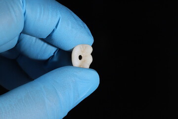 Expertise in jaw surgery and E-max and zirconium porcelain prostheses on dental implants....