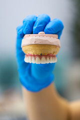 Full-arch porcelain implant-supported dental prosthesis for edentulous jaws with All-on-X and...