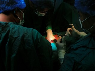 Surgery of abdominal, Resection of Small Bowels with Ligation of vessels during operation. Step by step surgery.