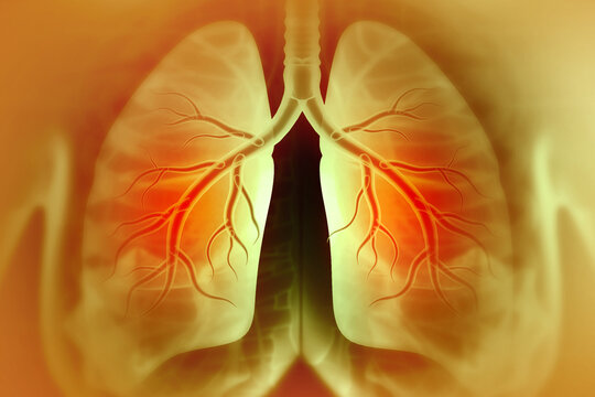 Chronic obstructive pulmonary disease, respiratory diseases, 3d illustration