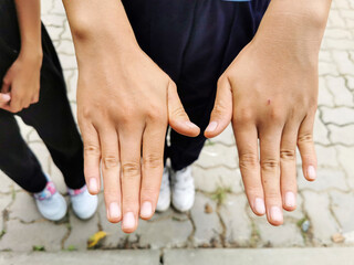 The Thai student shows her hands and fingers to the teacher for a nail and health check