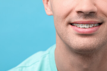 Obraz premium Smiling man with dental braces on light blue background, closeup. Space for text