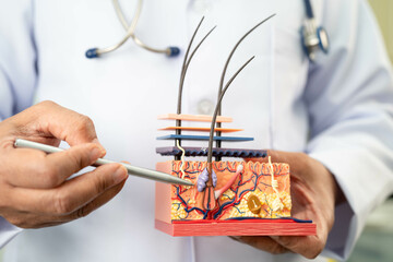 Hair transplant, Asian dermatologist doctor holding skin structure anatomy model for treatment in...