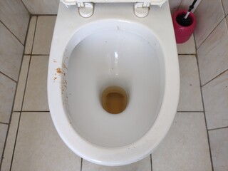 Dirty toilet with urine and traces of vomit