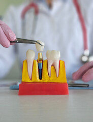 Demonstration of dental implant procedure with models and tools