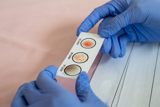A medical officer wearing blue gloves is holding a blood type checking sample paper in a laboratory or hospital