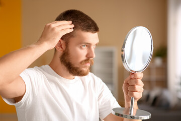 Handsome young man with hair loss problem and mirror at home